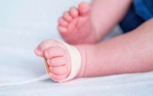 تداوم خدمات آزمایش پاشنه‌ی پا نوزادان در مرکز خدمات جامع سلامت شماره ۴ رشت
